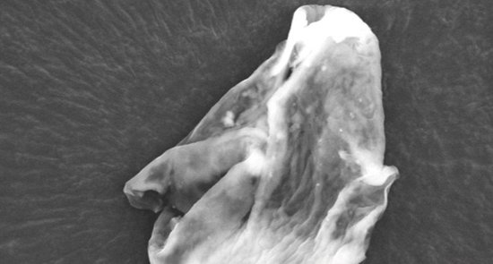 英謝菲爾德大學的研究人員在探空氣球中采集樣本中發現了硅藻屬植物